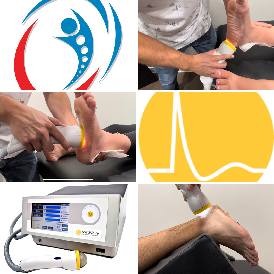 Curious About Plantar Fasciitis Treatment? Does SoftWave Therapy Work?